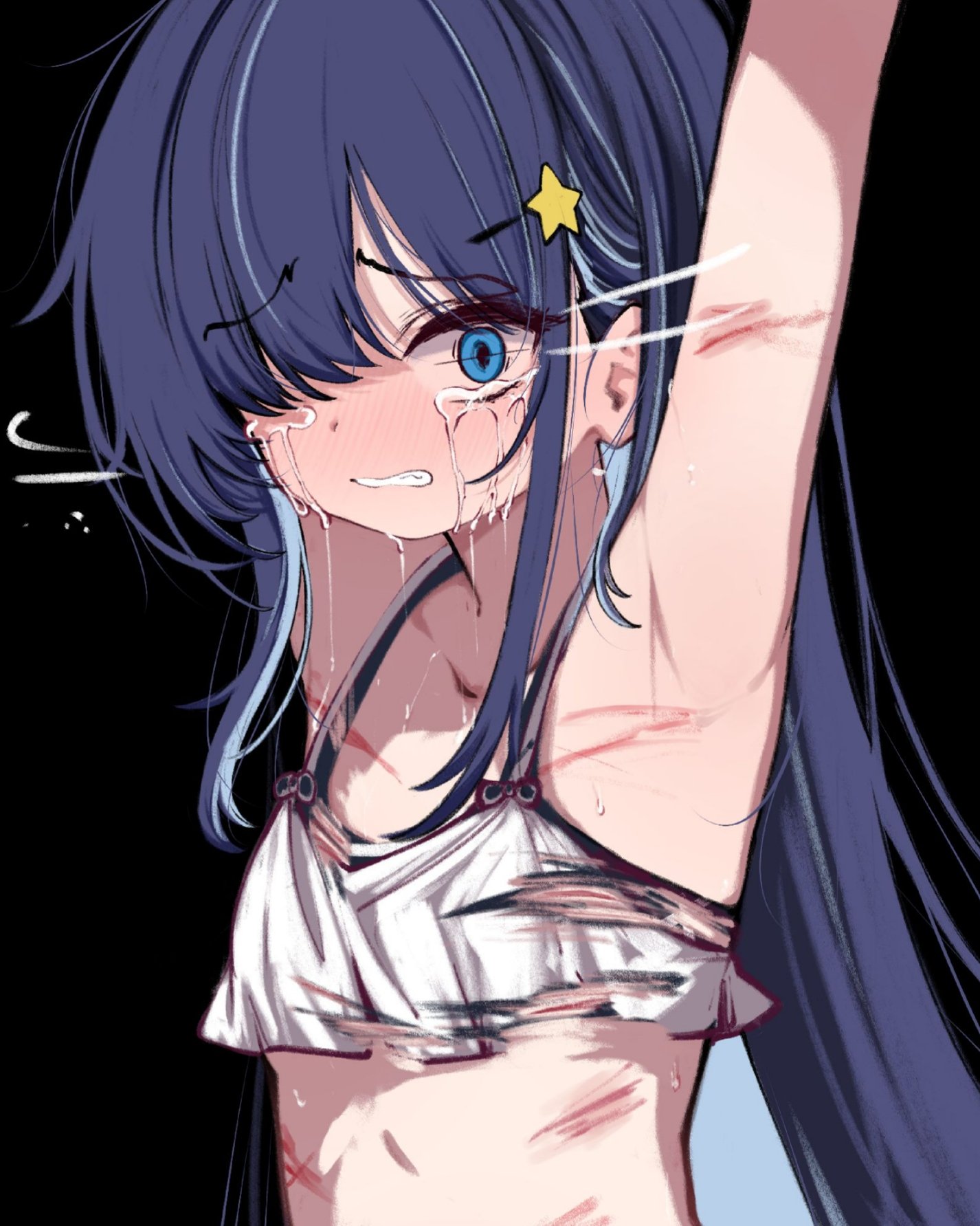 kimhiro, original, highres, 1girl, armpits, arms up, bikini, black background, black bikini, blue eyes, bruise, bruise on arm, bruise on chest, bruise on stomach, clenched teeth, colored inner hair, constricted pupils, crying, crying with eyes open, hair ornament, injury, long hair, multicolored hair, navel, one eye covered, scared, simple background, solo, star (symbol), star hair ornament, stomach, streaming tears, swimsuit, tears, teeth, torn clothes, very long hair