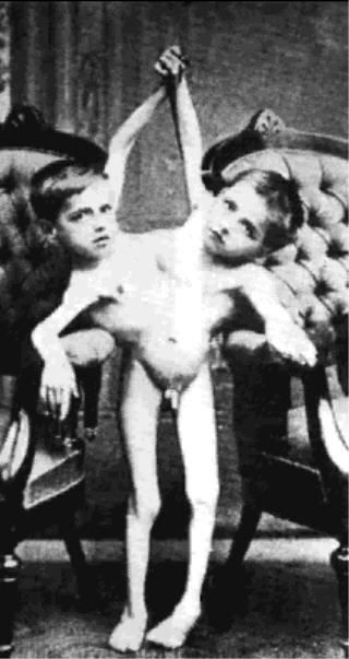 photo (medium), 2boys, conjoined, giacomo batista, giovanni tocci, monochrome, multiple boys, nude, penis
